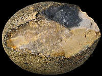 Split nodule of CE4a