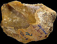 Small residual nodule