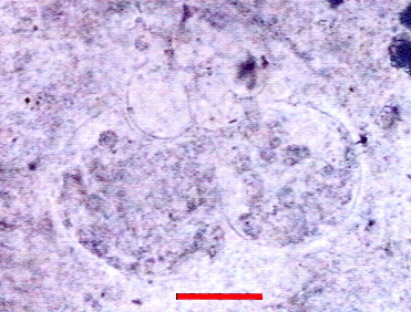 Microphotograph of Globotruncanidae