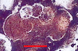 Microphotograph of Globotruncanidae