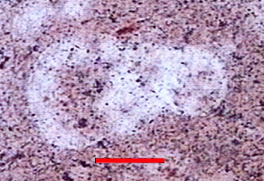 Microphotograph of Globotruncanidae