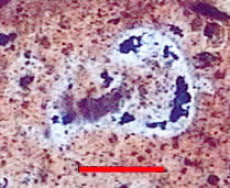 Microphotograph of Globotruncanidae