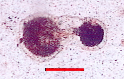 Microphotograph of Globotruncanidae