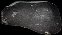 Large nodule
